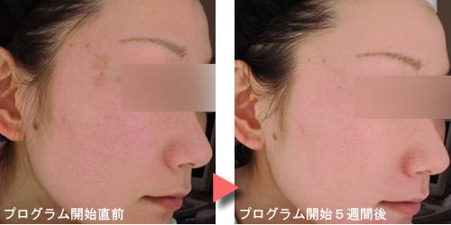オバジ体験談写真