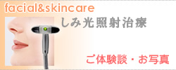 しみ光治療